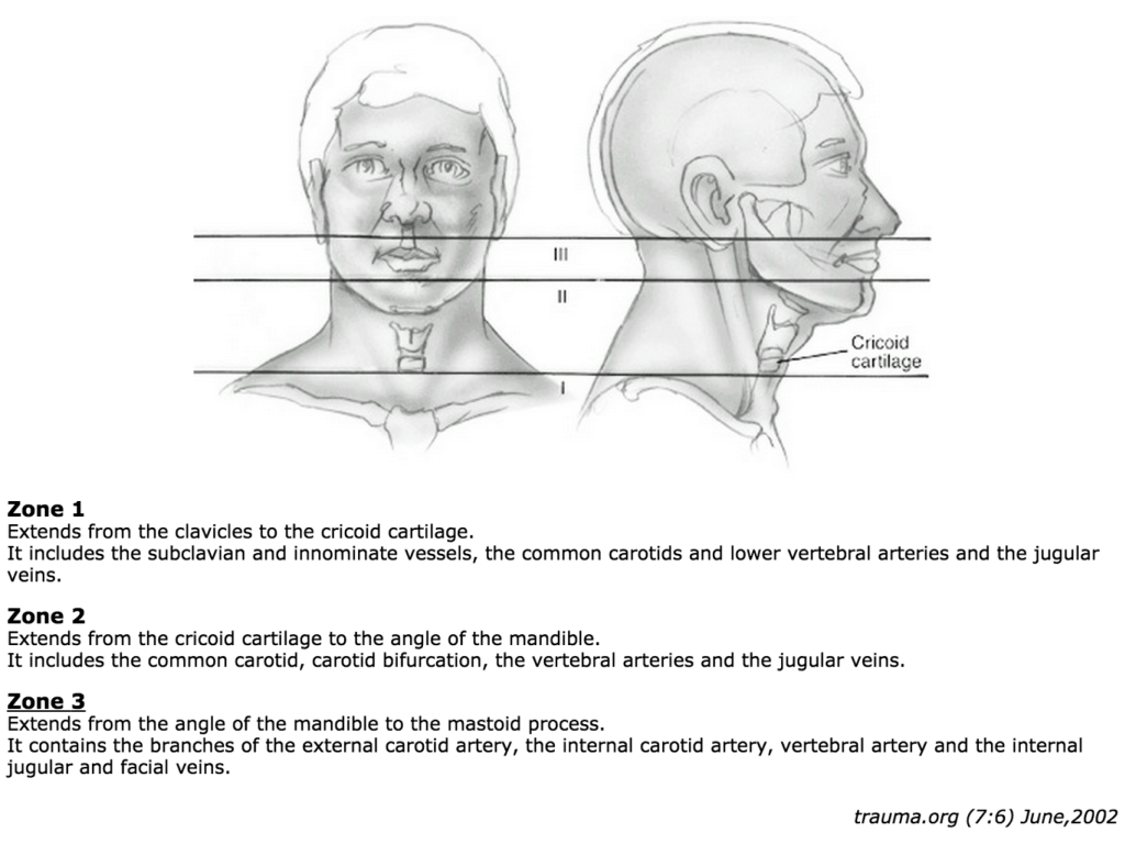Zones of the Neck